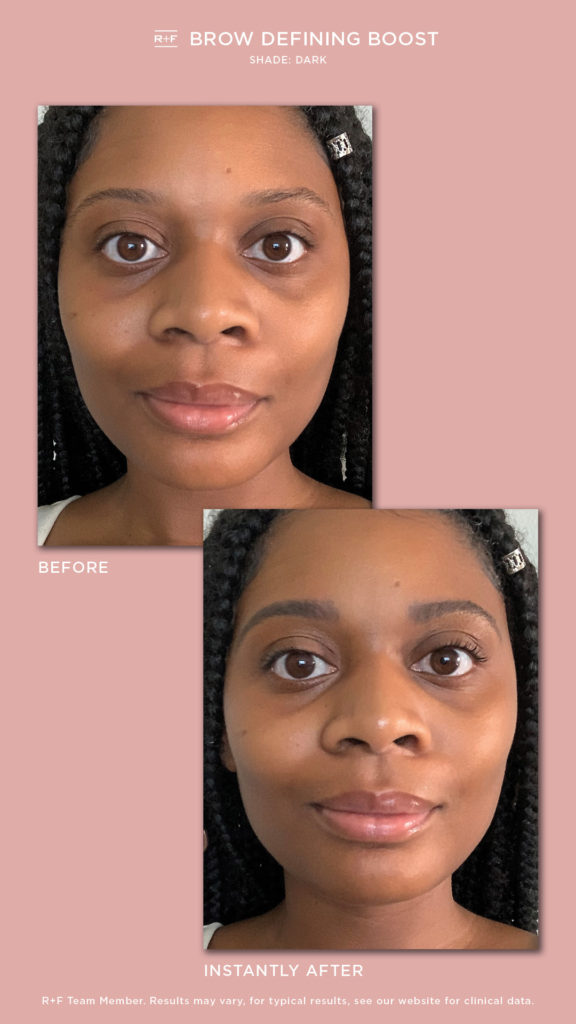 Rodan and Fields Before and After