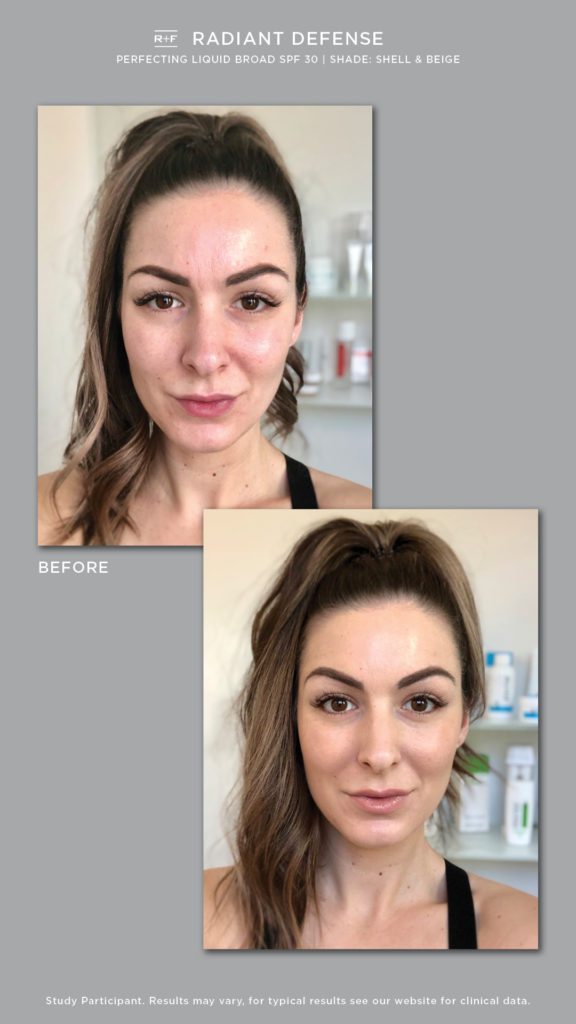 rodan and fields spotless before and after
