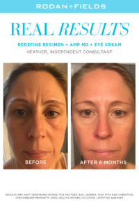 20 Rodan and Fields Before and After Pictures That Will Shock You - The ...